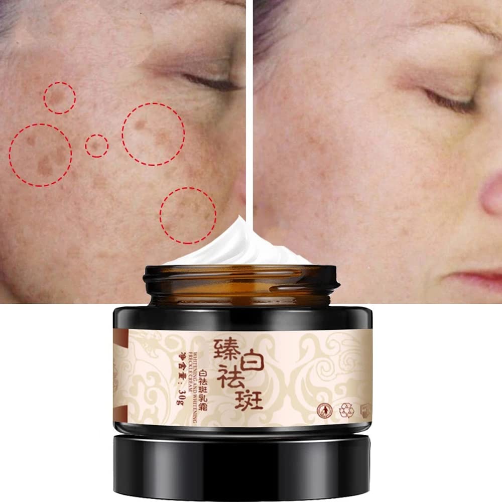 Amazon.com: CHOUBAGUAI 30g Powerful Whitening Freckle Cream Plant